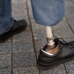 kaki prostetik