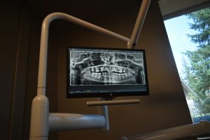 Mesin X-ray